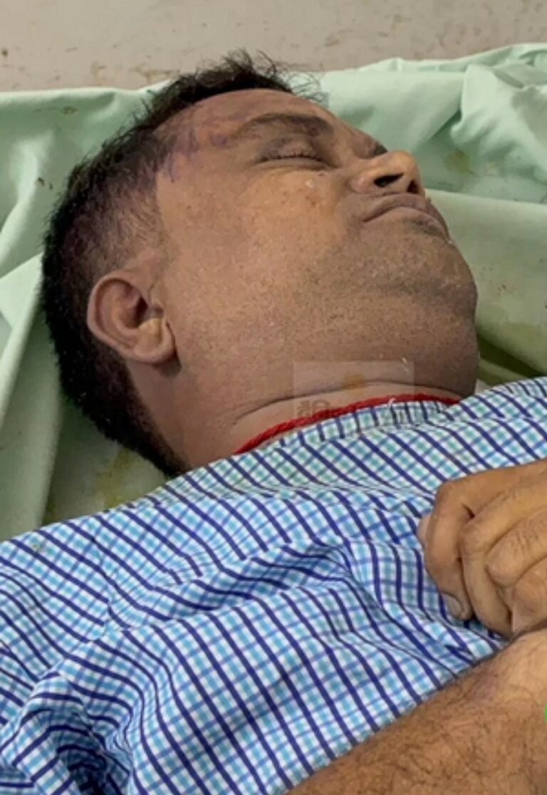जन्मदिवस की पार्टी के बाद हुए विवाद में बोलेरो कैंपर से कुचलकर युवक की हत्या
